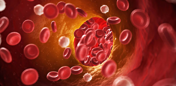 Bild zu Nach der Thrombose - Wann ist ein Thrombophilie-Screening sinnvoll?