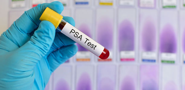 Bild zu Prostata - Neues zum PSA-Test
