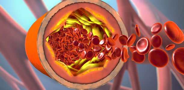 Bild zu Cholesterin - Zu viel HDL ist auch nicht gut