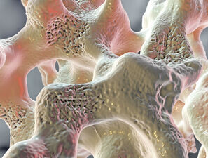 Bild zu Diabetes und Osteoporose - Risiken erkennen, Frakturen vermeiden