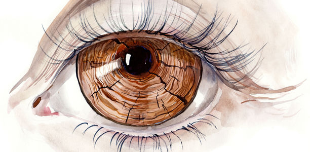 Bild zu Das kranke Auge - Was ist im Alter häufig?