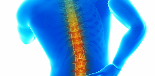 Bild zu Axiale Spondyloarthritis - Chronische Rückenschmerzen schnell korrekt einordnen