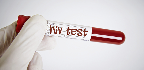 Bild zu HIV-Testung - Wo sind die Defizite, was kann besser werden?