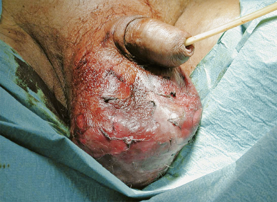 Urologische Notfalle Irreversible Schaden Verhindern Doctors Today. 