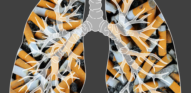 Bild zu COPD - Raucherlungen testen