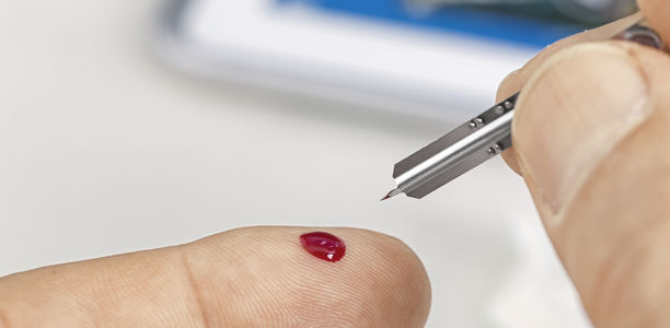 Bild zu Blutzucker korrekt messen - Viele Faktoren können das Ergebnis verfälschen