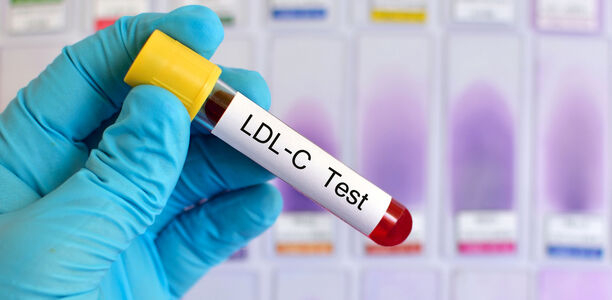 Bild zu Neues in Sachen LDL-Cholesterin - „Es lohnt sich, zu klotzen“