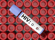 Bild zu AIDS - Weniger HIV-Infektionen