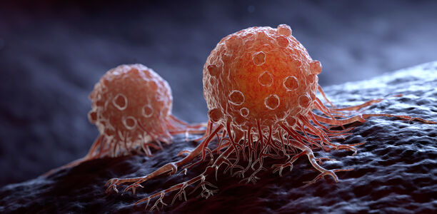 Bild zu Krebs - Statine bremsen Metastasen