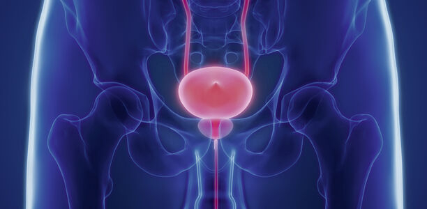 Bild zu Harnwegsinfekte und Prostatitis - Keim oder nicht Keim, das ist hier die Frage