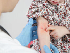 Bild zu Auch in der Hausarztpraxis häufig: - Hautinfektionen bei Kindern